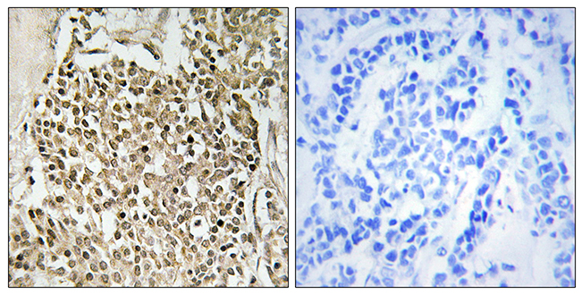 Anti-CEP350 Antibody
