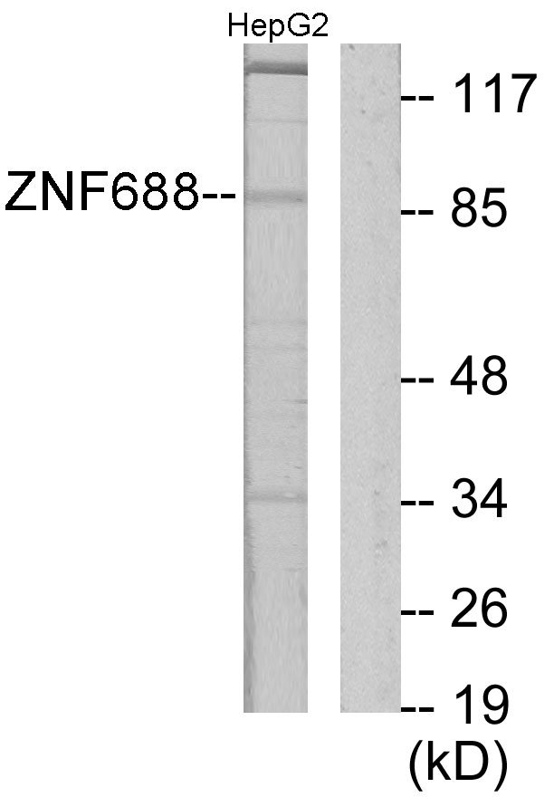 Anti-ZNF785 Antibody