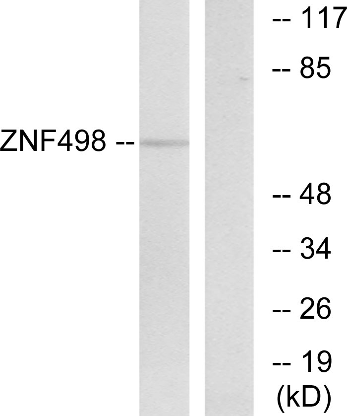 Anti-ZNF498 Antibody