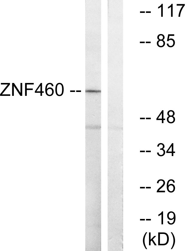 Anti-ZNF460 Antibody