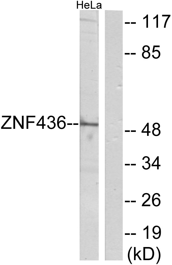 Anti-ZNF436 Antibody