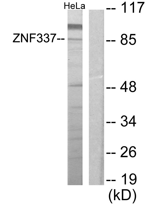 Anti-ZNF337 Antibody