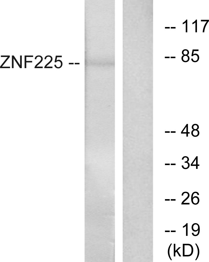 Anti-ZNF225 Antibody