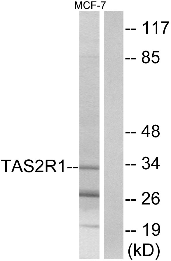 Anti-TAS2R1 Antibody
