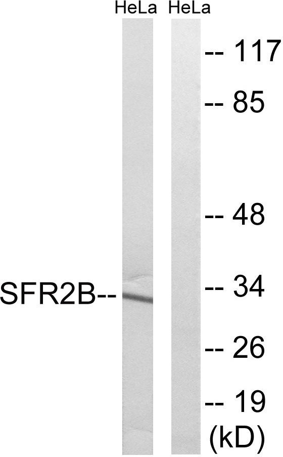 Anti-SFRS2B Antibody