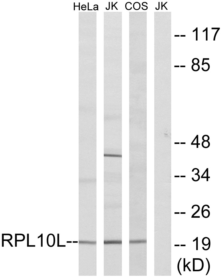 Anti-RPL10L Antibody