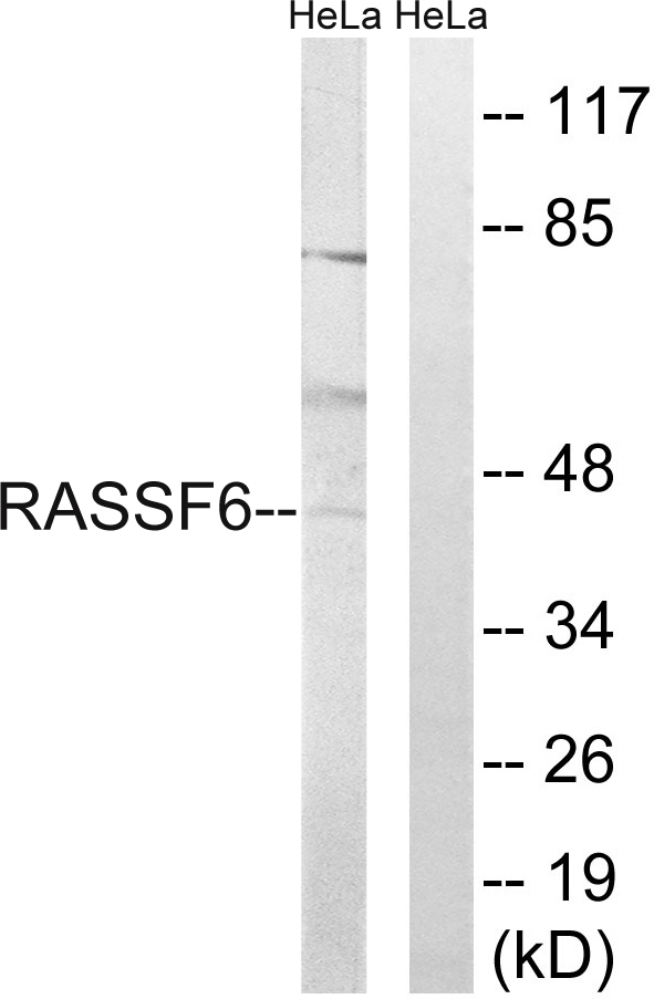 Anti-RASSF6 Antibody
