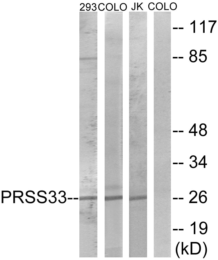 Anti-PRSS33 Antibody