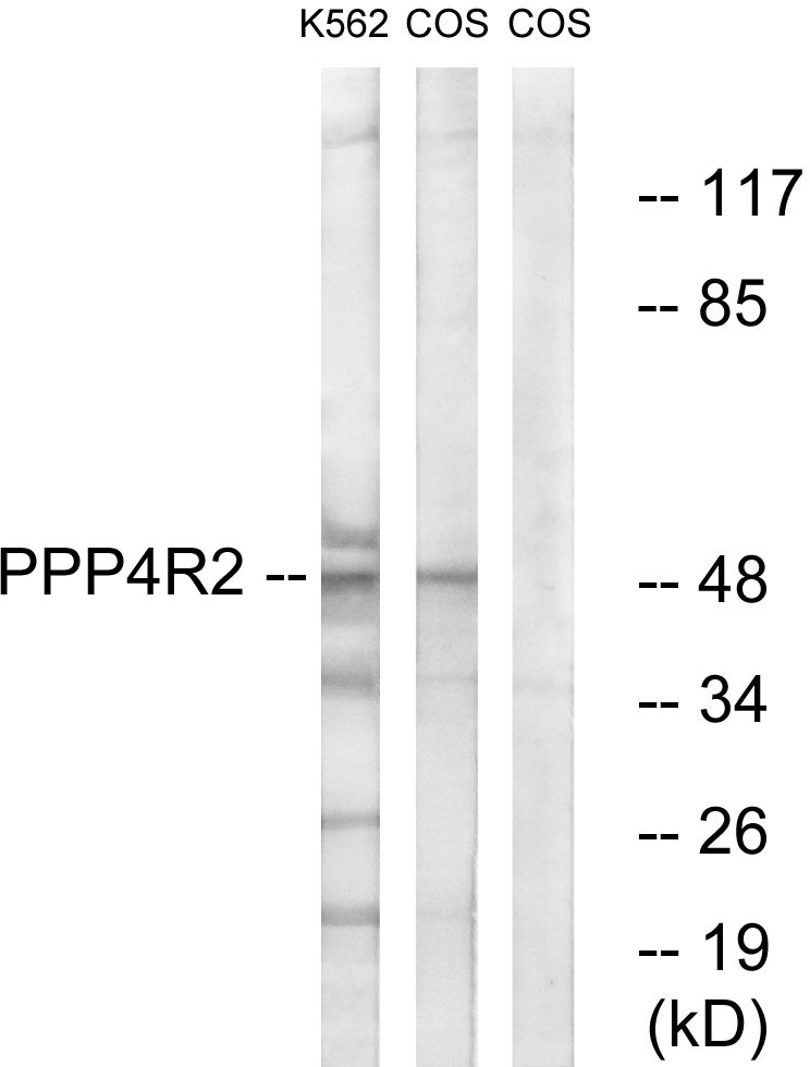 Anti-PPP4R2 Antibody