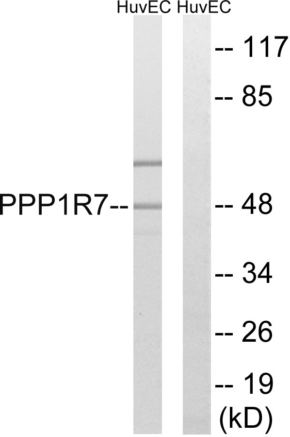 Anti-PPP1R7 Antibody