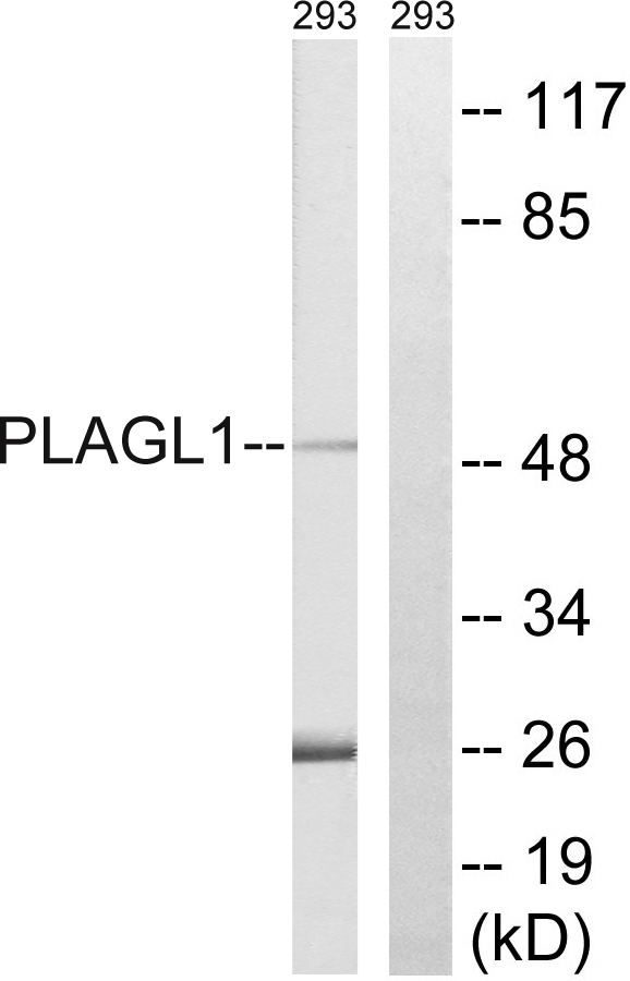 Anti-PLAGL1 Antibody
