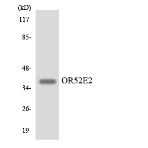 Anti-OR52E2 Antibody