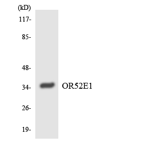 Anti-OR52E1 Antibody