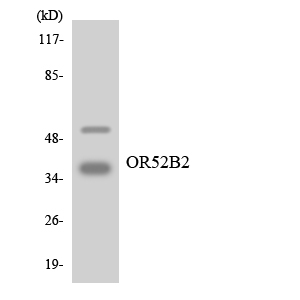 Anti-OR52B2 Antibody