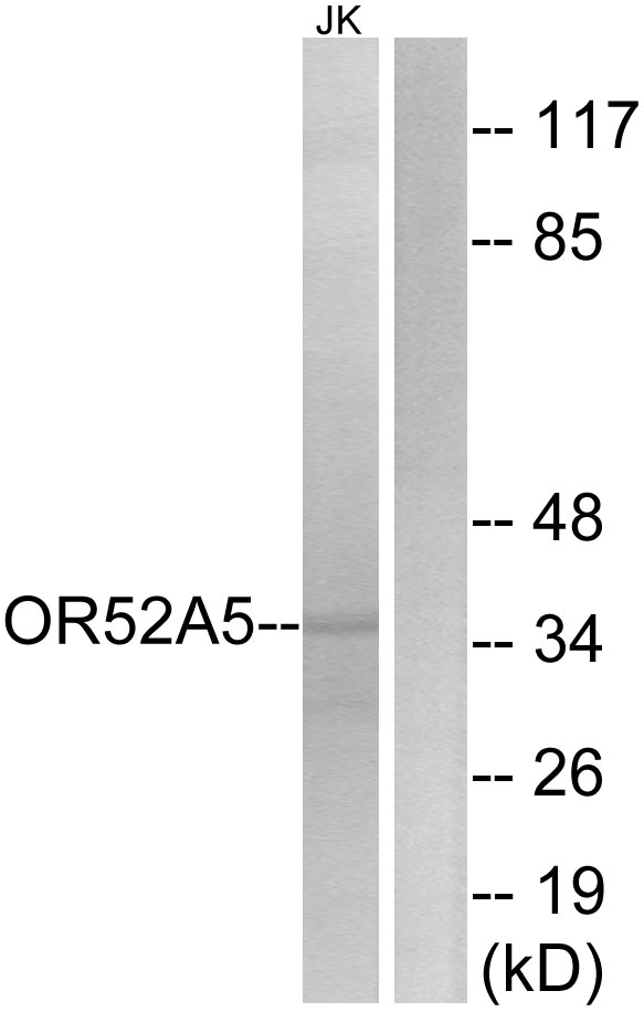 Anti-OR52A5 Antibody