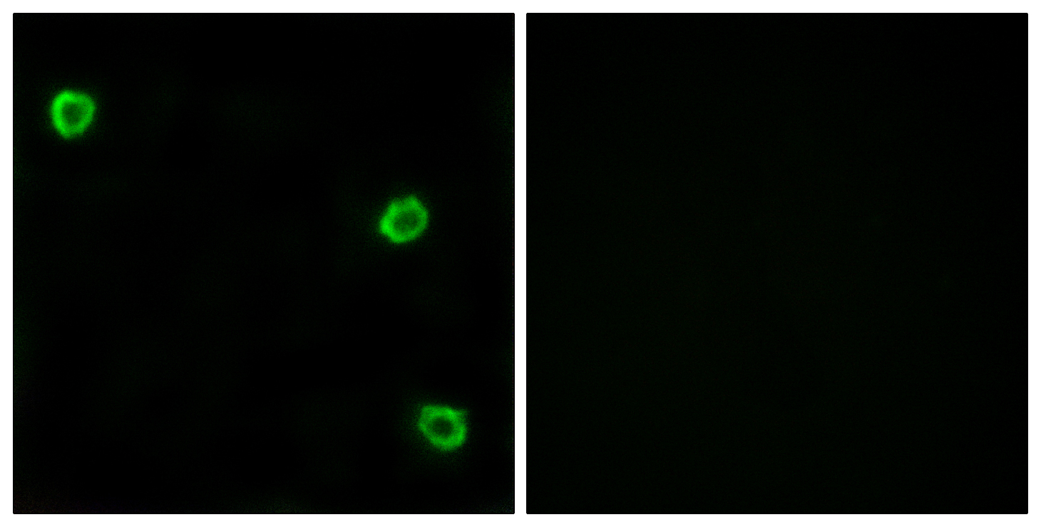 Anti-OR51Q1 Antibody