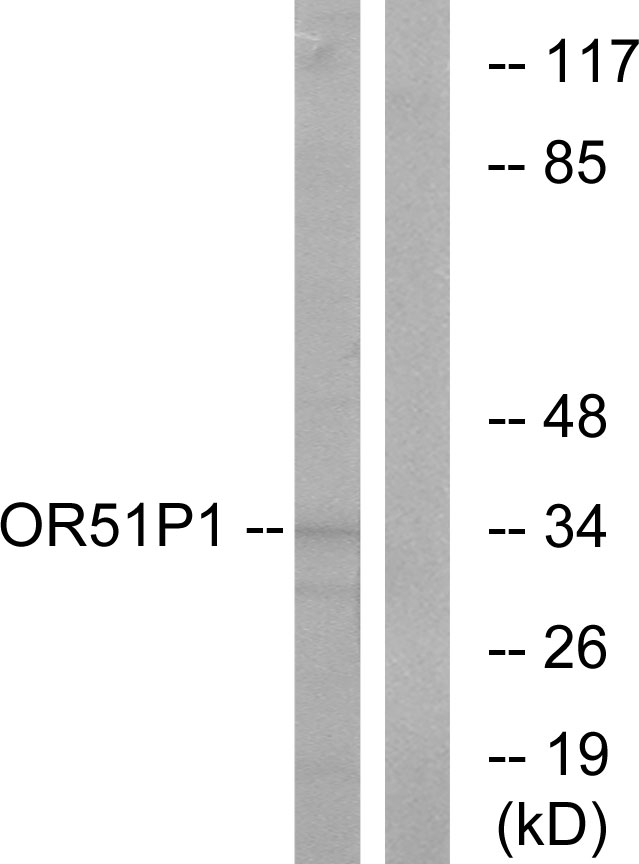 Anti-OR51D1 Antibody