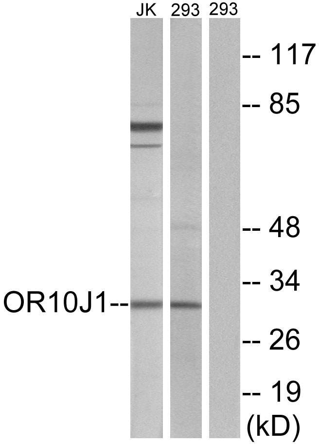 Anti-OR10J1 Antibody