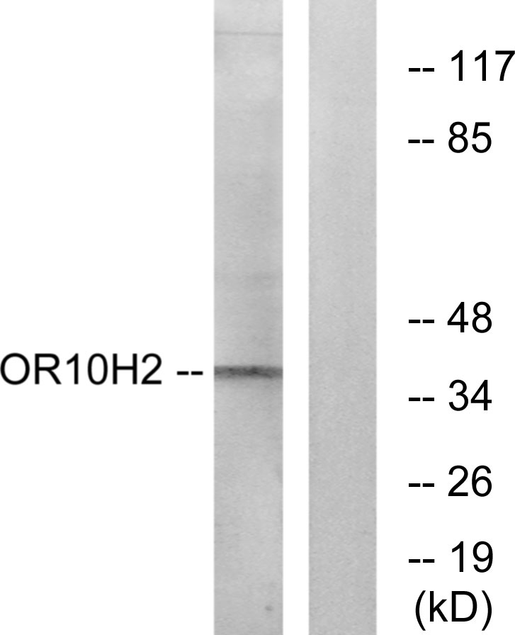 Anti-OR10H2 Antibody