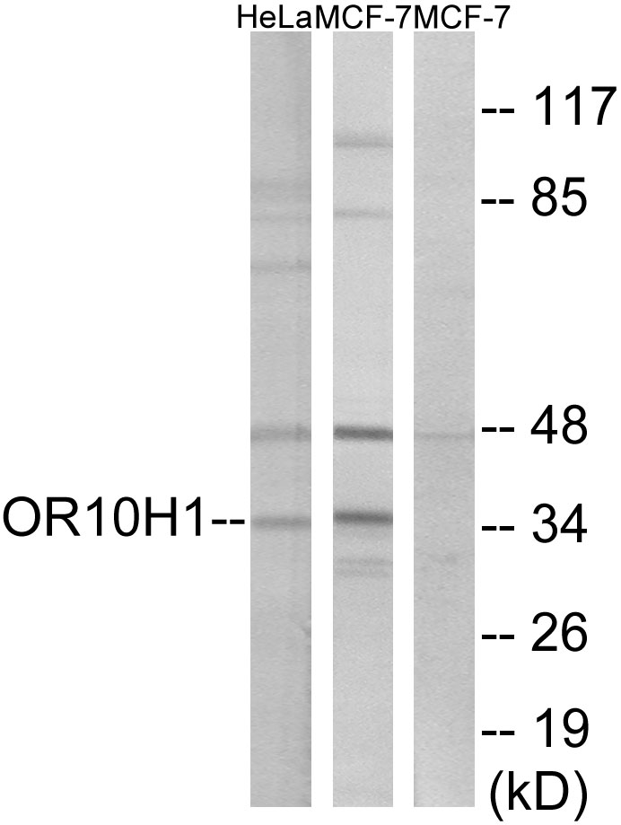 Anti-OR10H1 Antibody