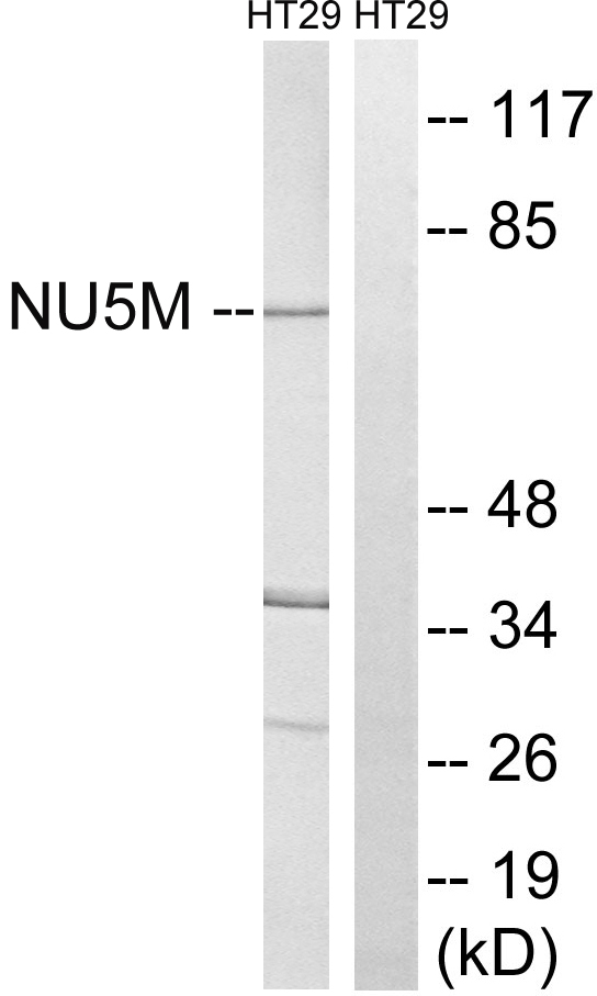 Anti-MT-ND5 Antibody
