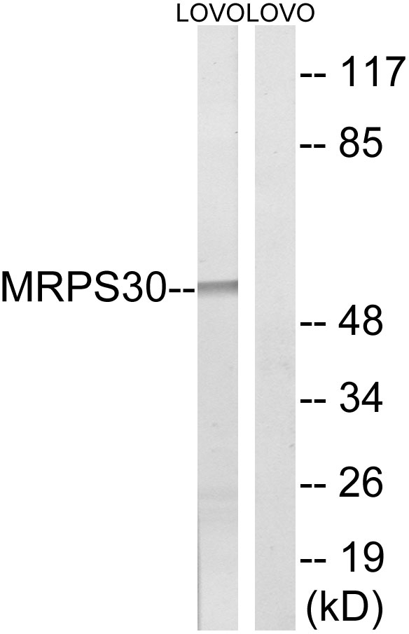 Anti-MRPS30 Antibody