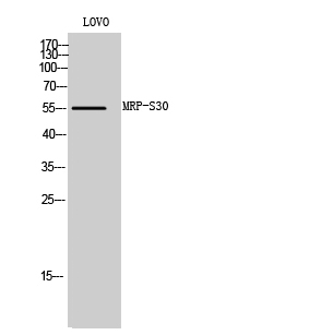 Anti-MRPS30 Antibody Anti-MRPS30 Antibody