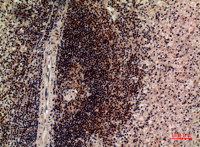 Anti-LILRB5 Antibody Anti-LILRB5 Antibody