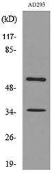Anti-IFNAR2 Antibody - Identical to Abcam (ab190664)