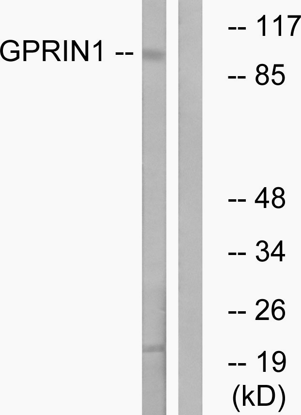 Anti-GPRIN1 Antibody