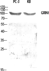 Anti-GPRIN1 Antibody Anti-GPRIN1 Antibody