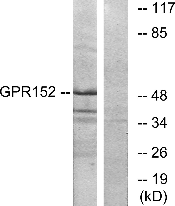 Anti-GPR152 Antibody