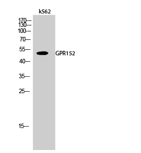 Anti-GPR152 Antibody Anti-GPR152 Antibody
