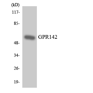 Anti-GPR142 Antibody