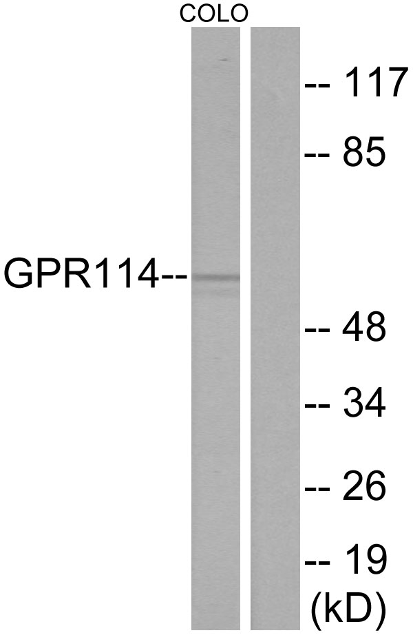 Anti-GPR114 Antibody