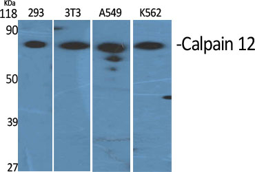 Anti-CAPN12 Antibody