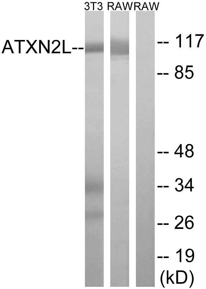 Anti-ATXN2L Antibody