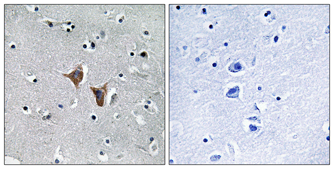 Anti-WASF4 Antibody