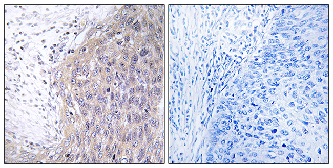 Anti-POLG2 Antibody