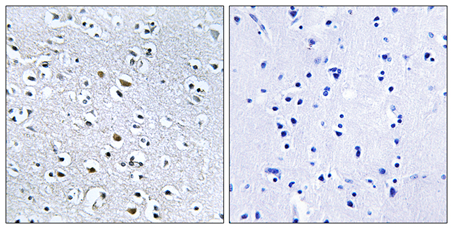 Anti-NPHP4 Antibody