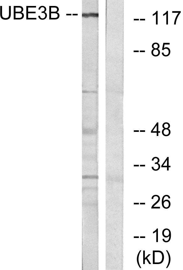 Anti-UBE3B Antibody
