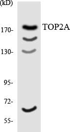 Anti-TOP2A Antibody