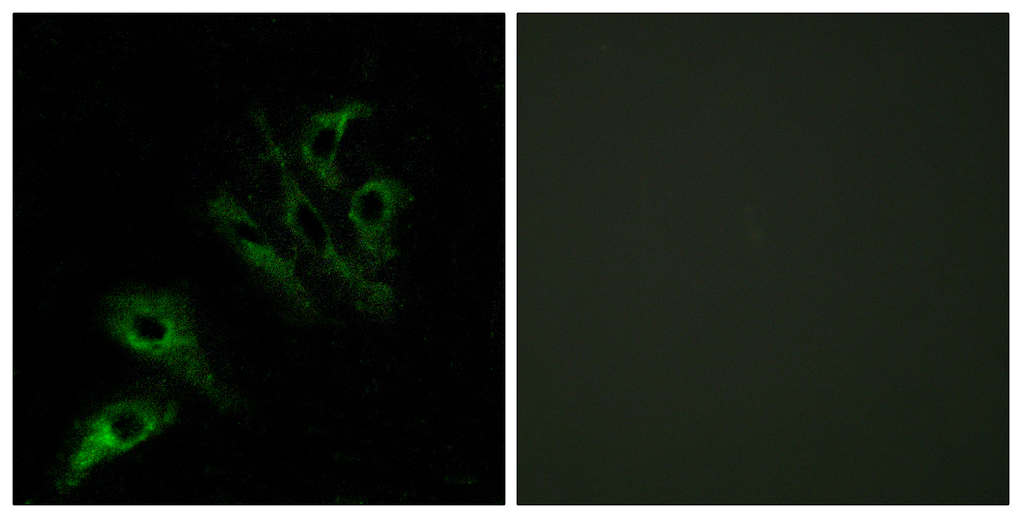 Anti-TNFL4 Antibody