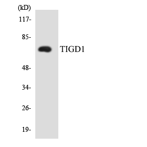 Anti-TIGD1 Antibody