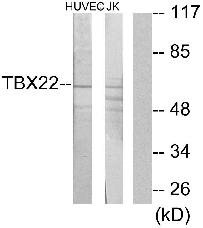 Anti-TBX22 Antibody