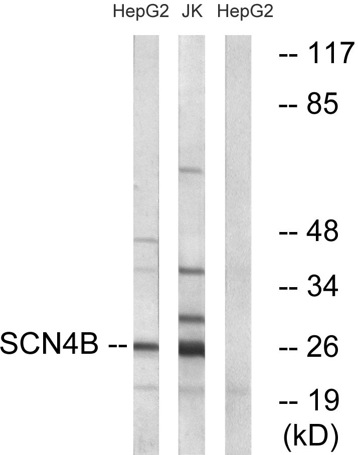 Anti-SCN4B Antibody