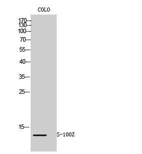 Anti-S100Z Antibody Anti-S100Z Antibody