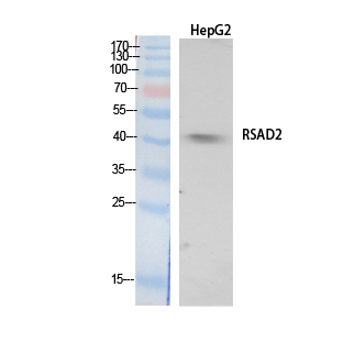 Anti-RSAD2 Antibody