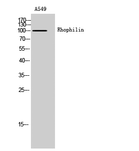 Anti-RHPN1 Antibody