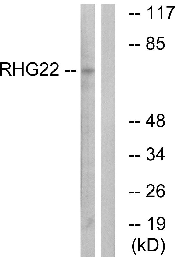 Anti-RHG22 Antibody